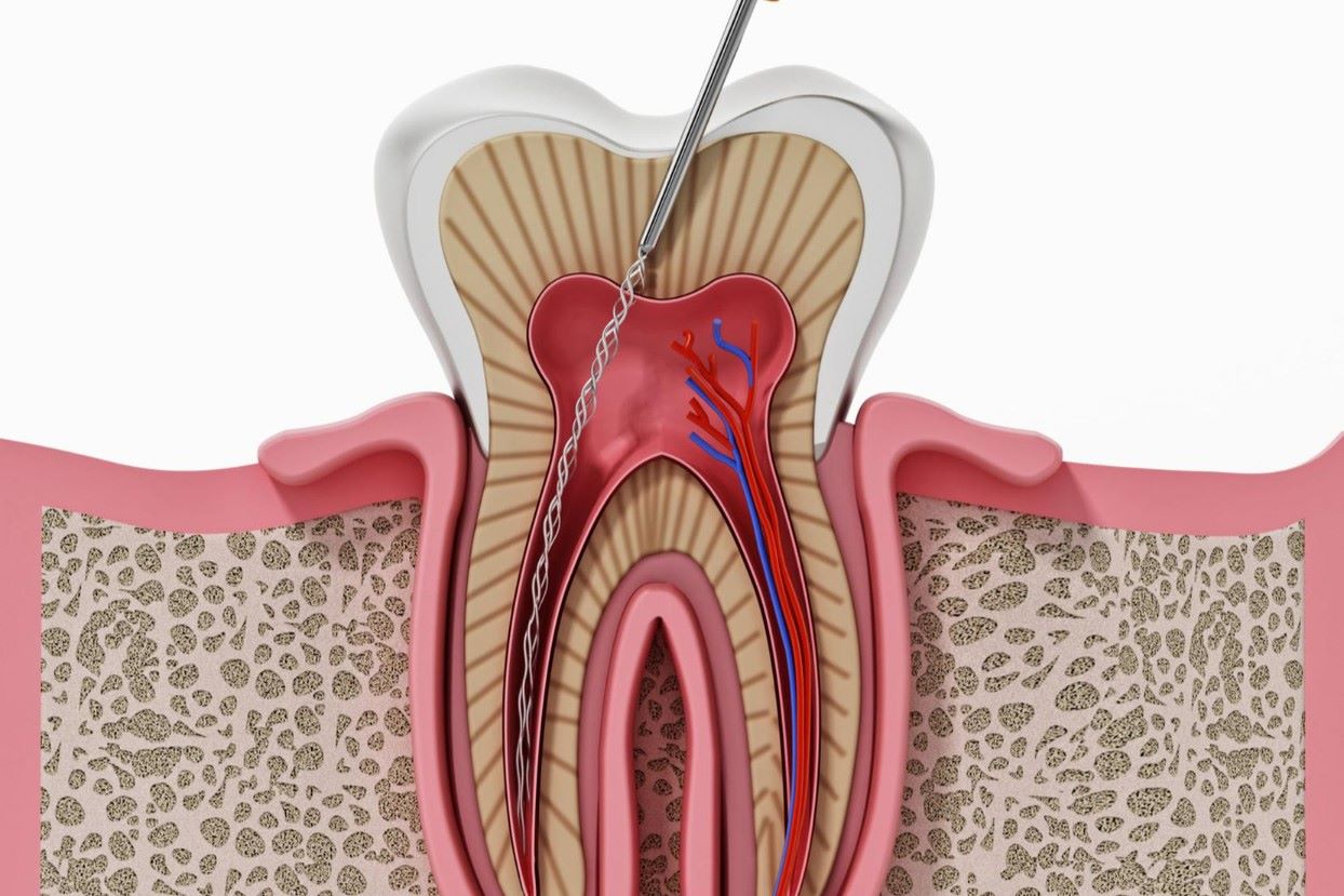 Endodontie